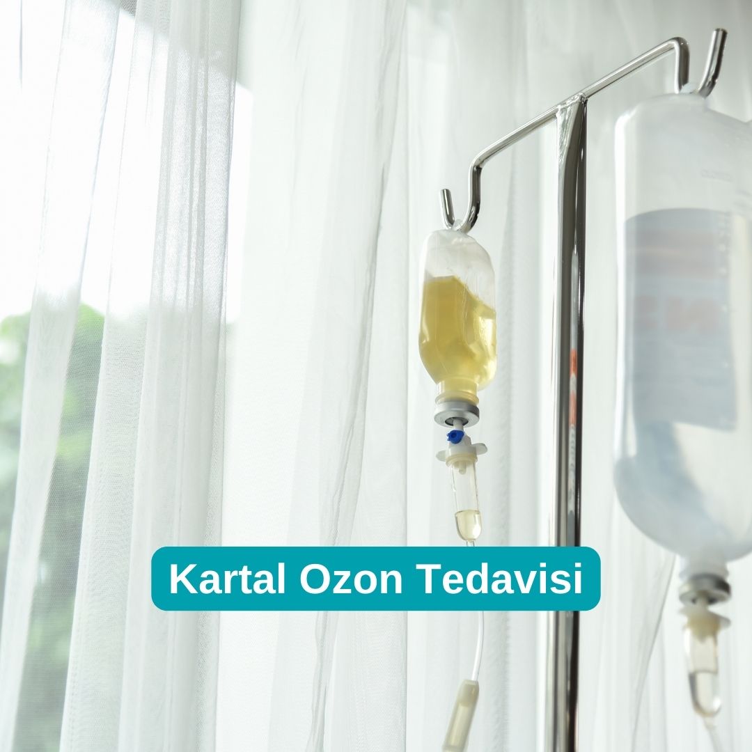 Kartal Ozon Tedavisi